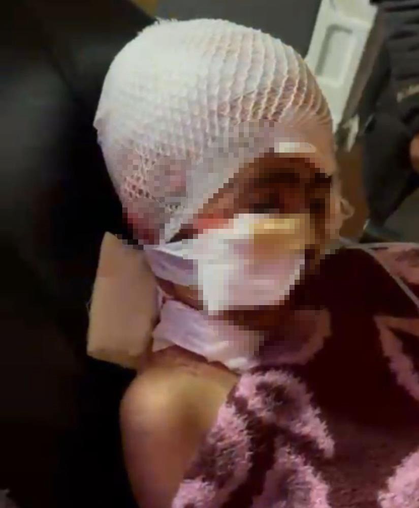 Narman Belediye Başkanı Aydemir Adem Kınalı’ya soruşturma izni