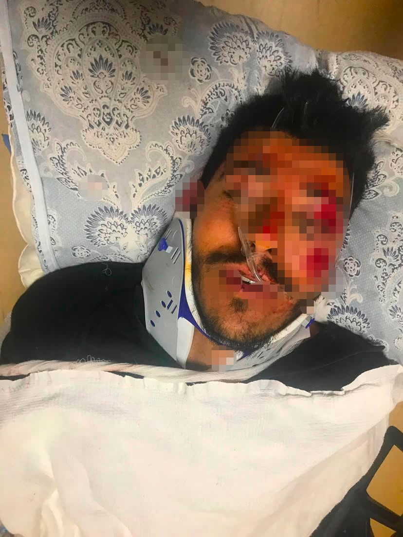 Beylikdüzü’nde feci kaza kamerada: 2’si ağır 6 kişi yaralandı