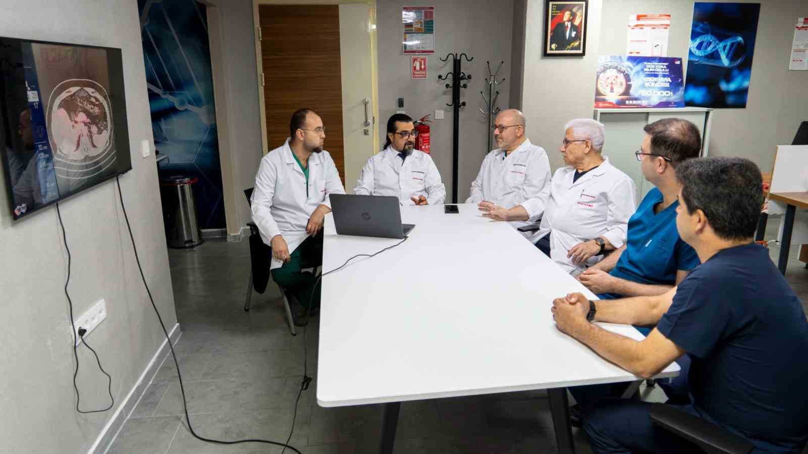 Kemosatürasyonda uluslararası deneyim