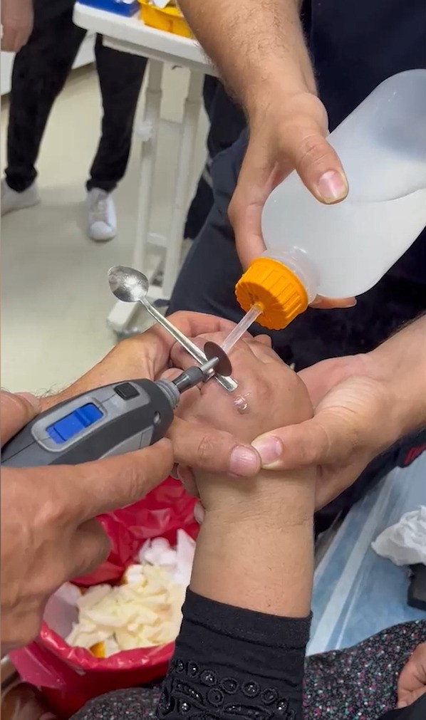Yüzüğü parmağına sıkışan kadının yardımına itfaiye koştu