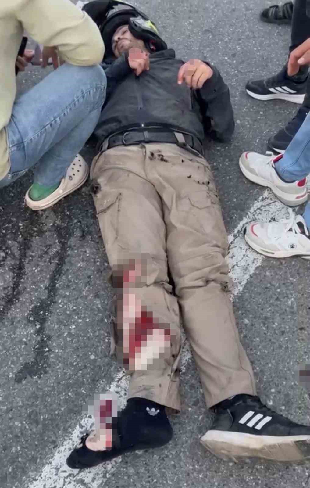 Iğdır-Doğubeyazıt yolunda motosiklet bariyerlere çarptı: 2 yaralı