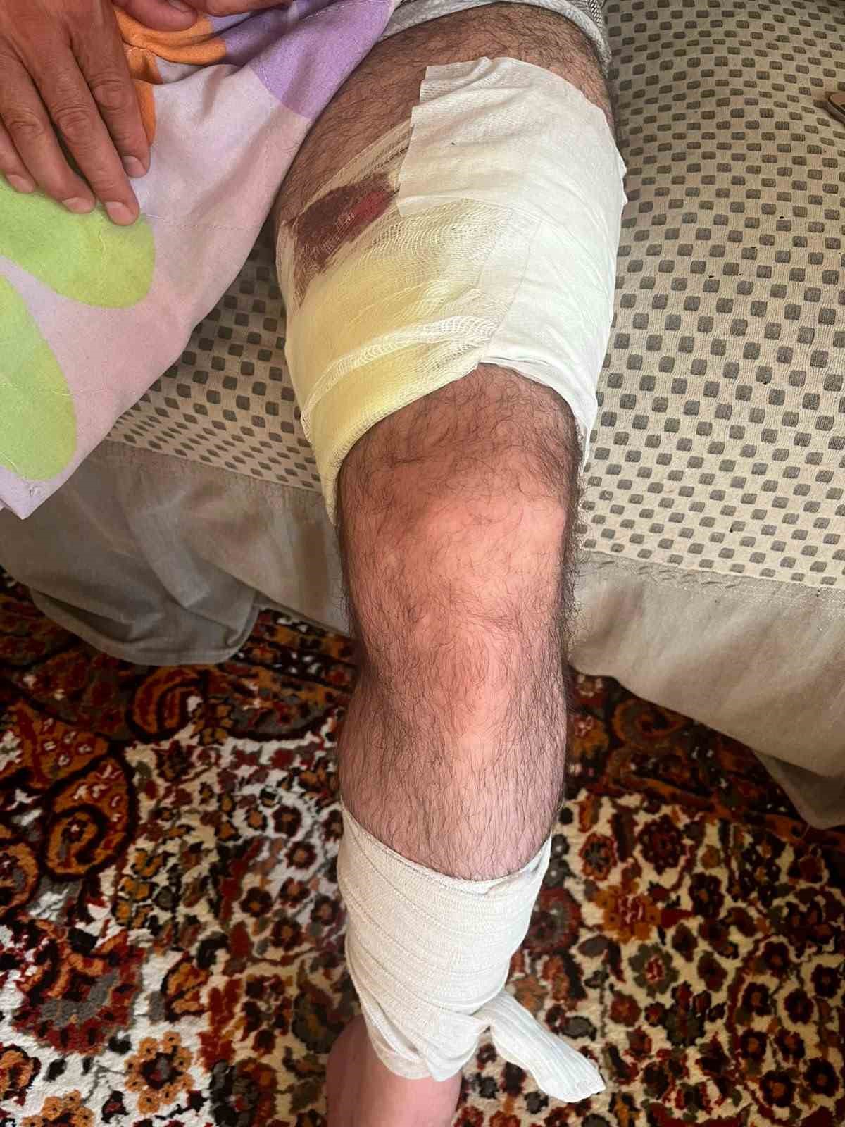 Muradiye’de arazi anlaşmazlığı silahlı kavgaya dönüştü: 1 yaralı
