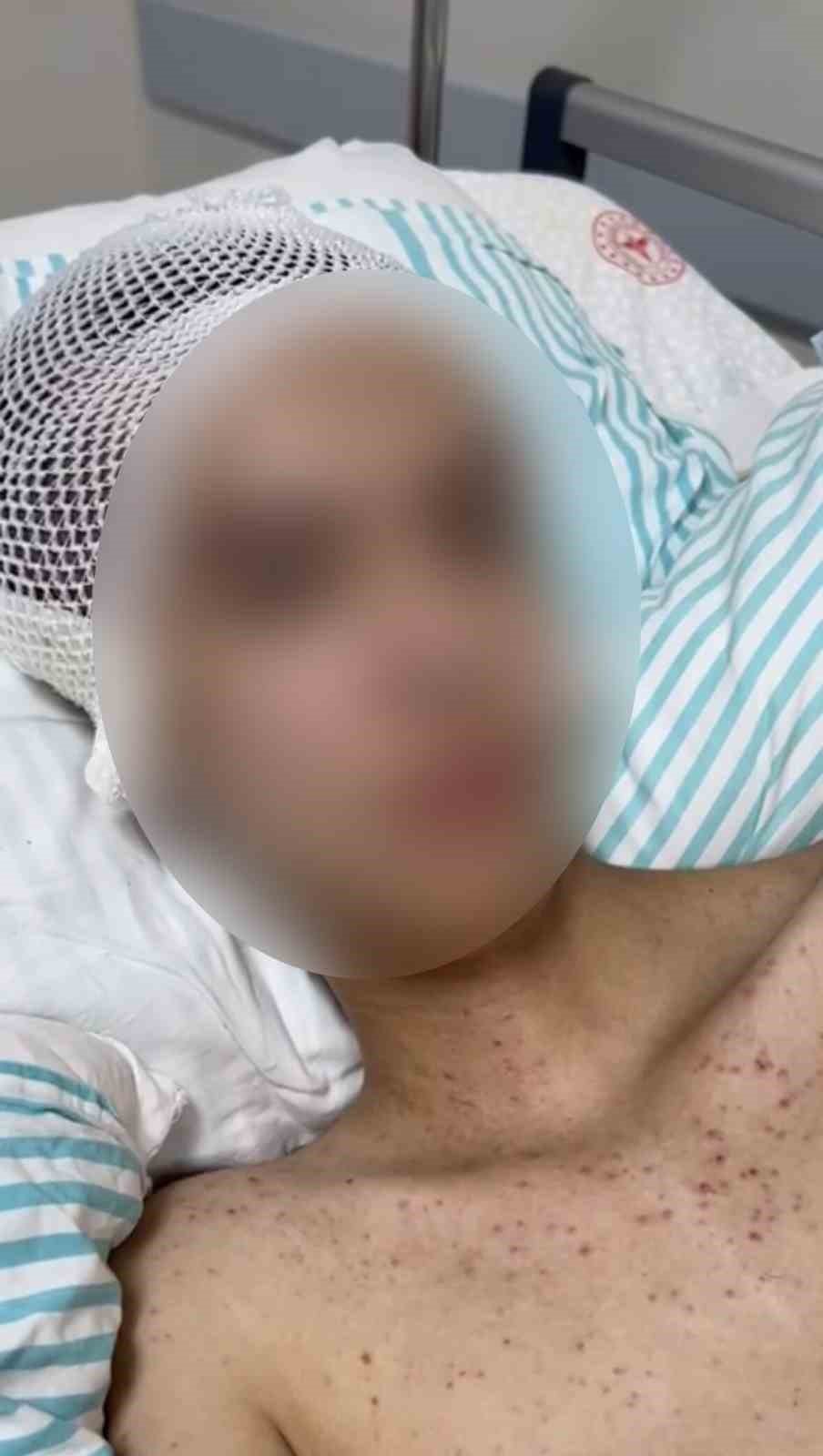 Tacize direndiği iddiasıyla başından vurulan çocuk felç kaldı