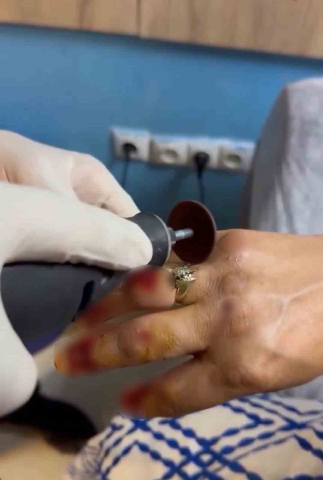 Kazada yaralanan kadının parmağına sıkışan yüzüğü itfaiye ekipleri çıkardı
