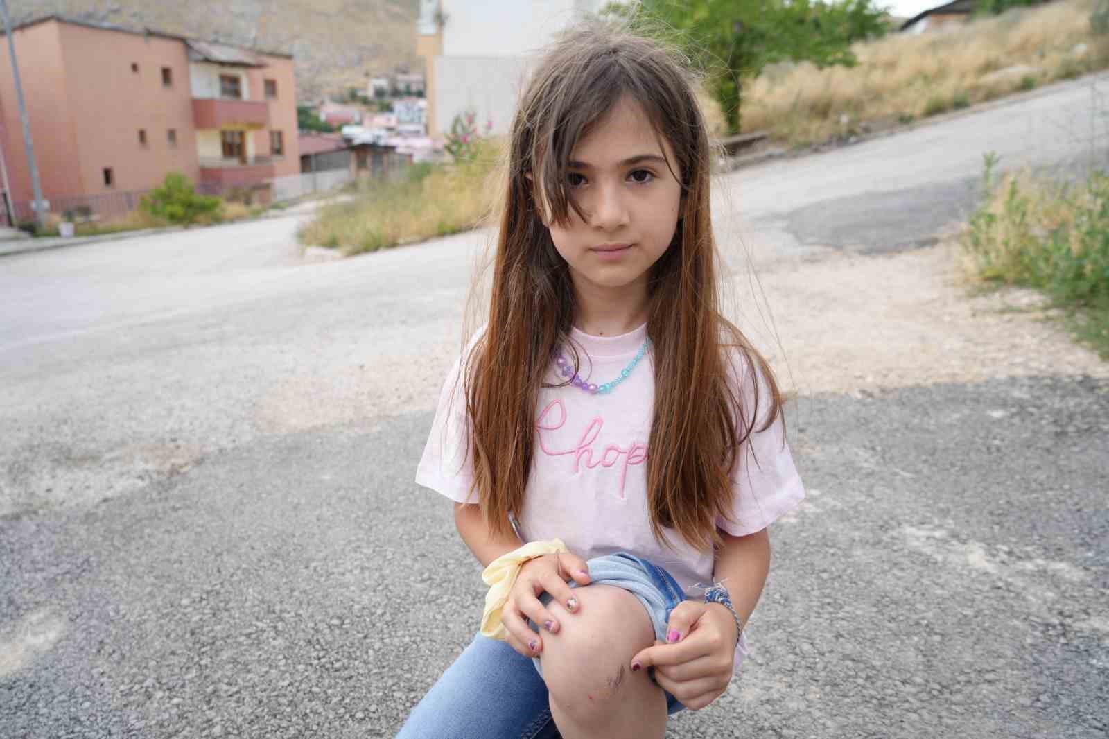 Bayburt’a tatile gelen iki kuzen köpeklerden kaçarken yaralandı