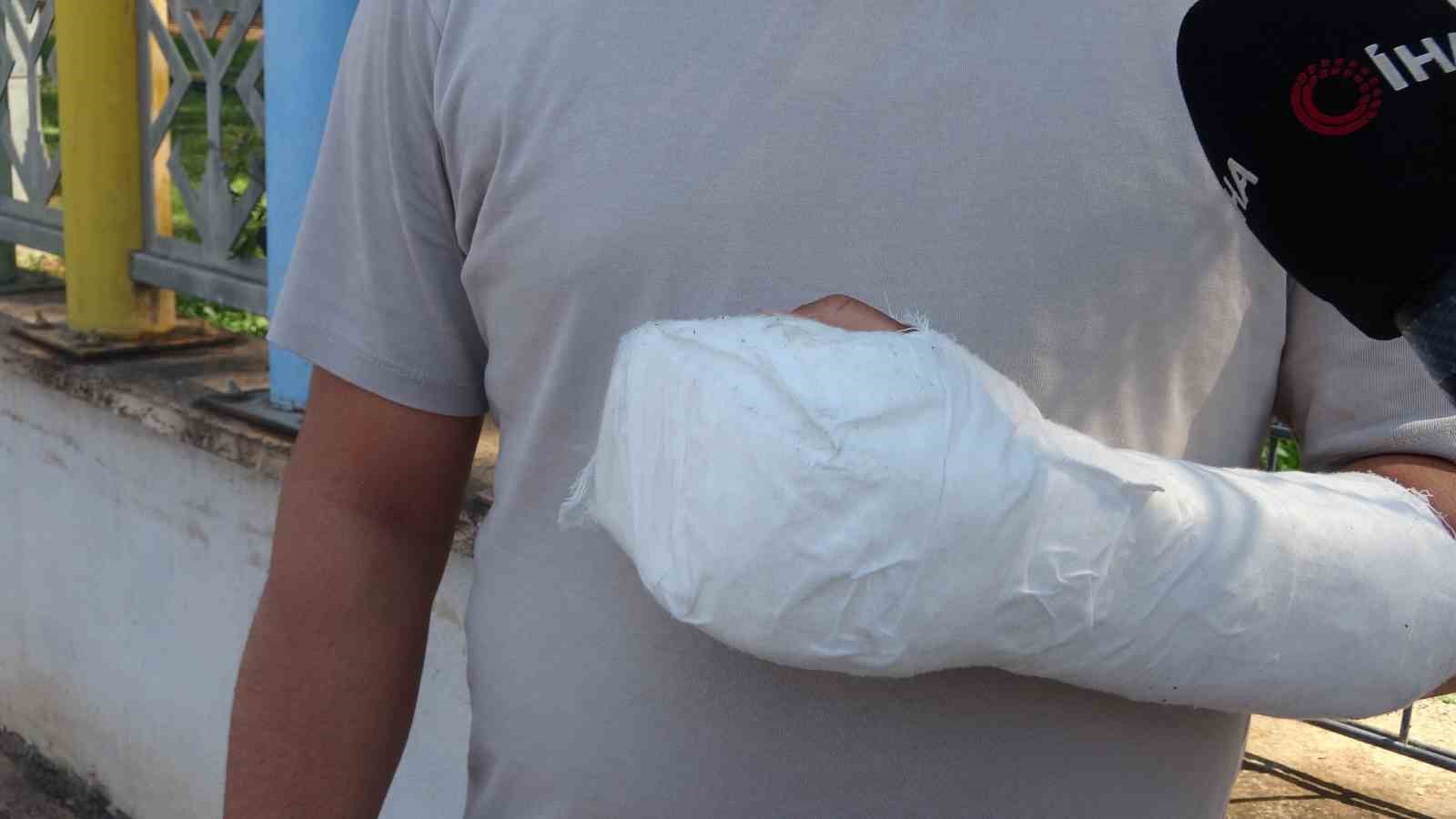 Sipariş almaya gittiği işletmede döner bıçaklı saldırıya uğradı, eline 30 dikiş atıldı