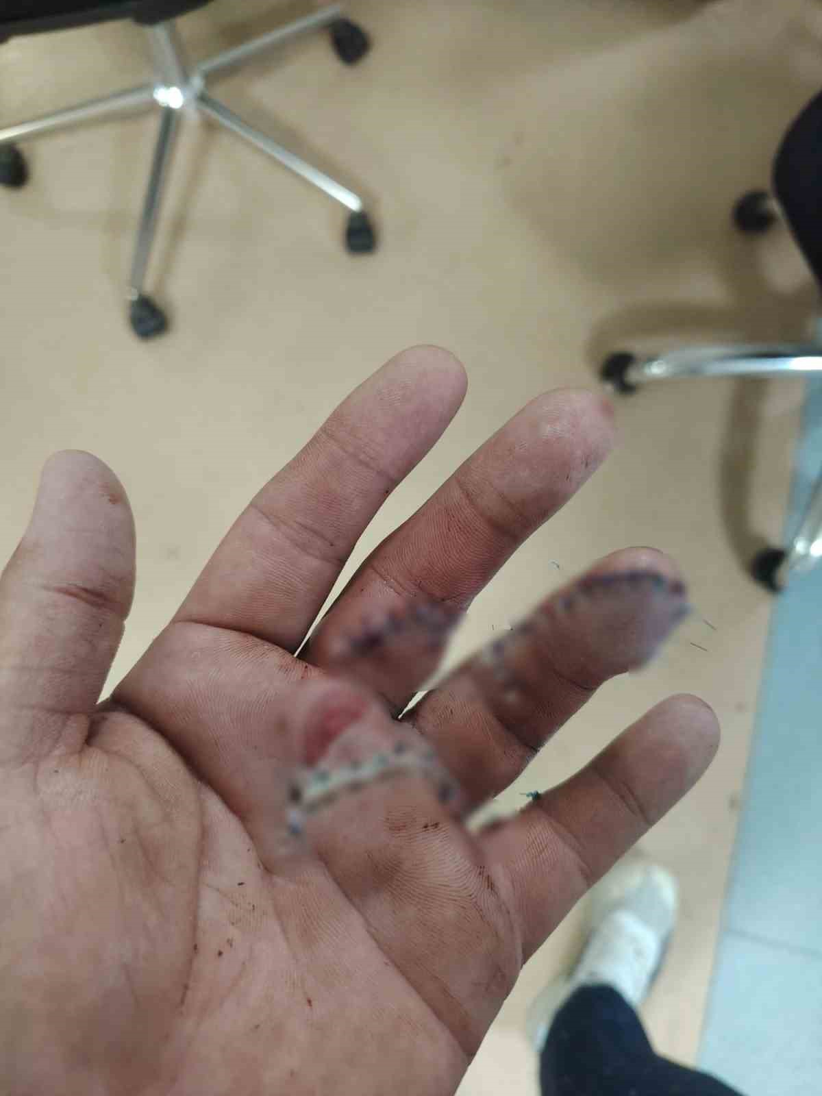 Sipariş almaya gittiği işletmede döner bıçaklı saldırıya uğradı, eline 30 dikiş atıldı