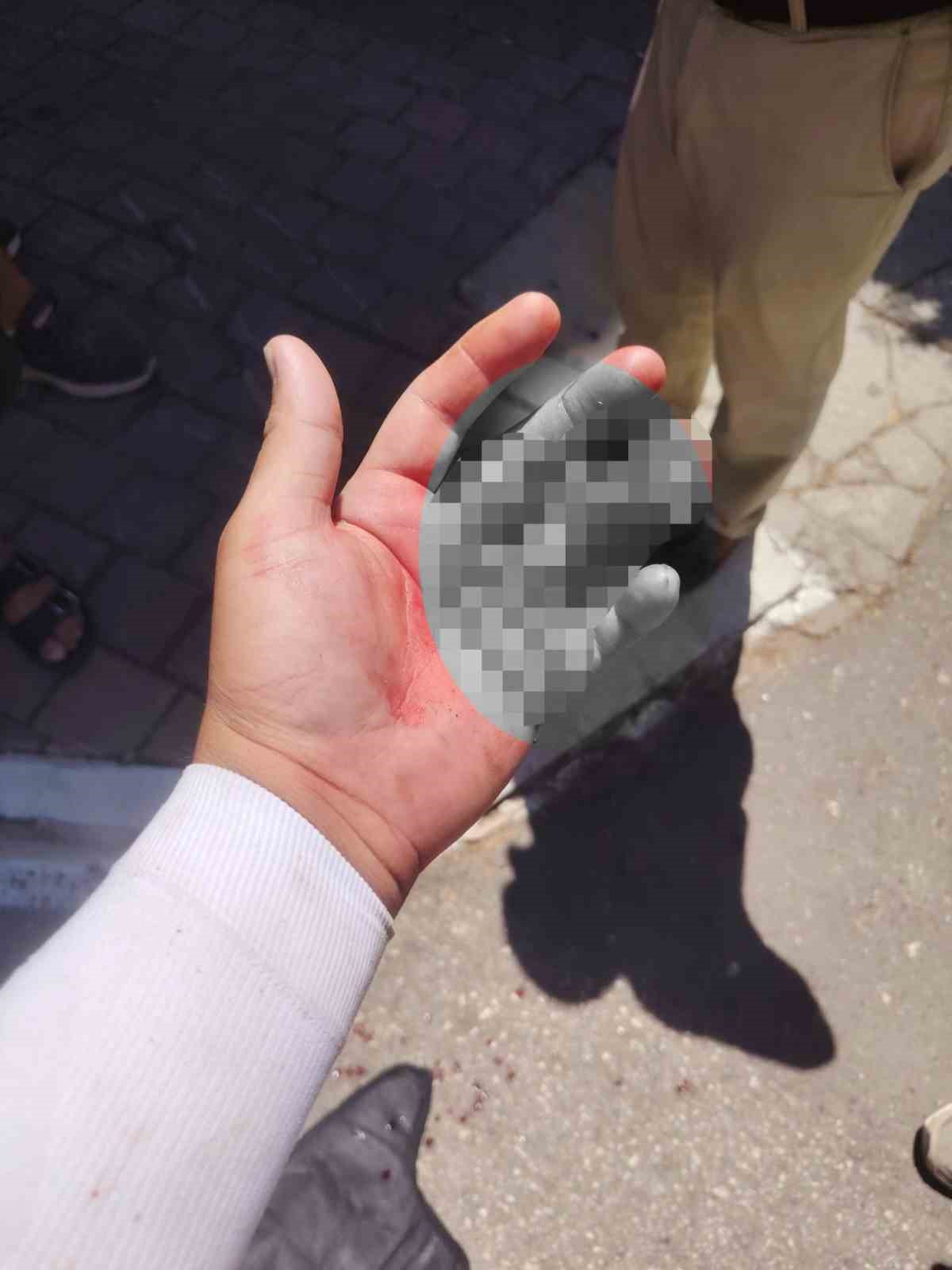 Sipariş almaya gittiği işletmede döner bıçaklı saldırıya uğradı, eline 30 dikiş atıldı