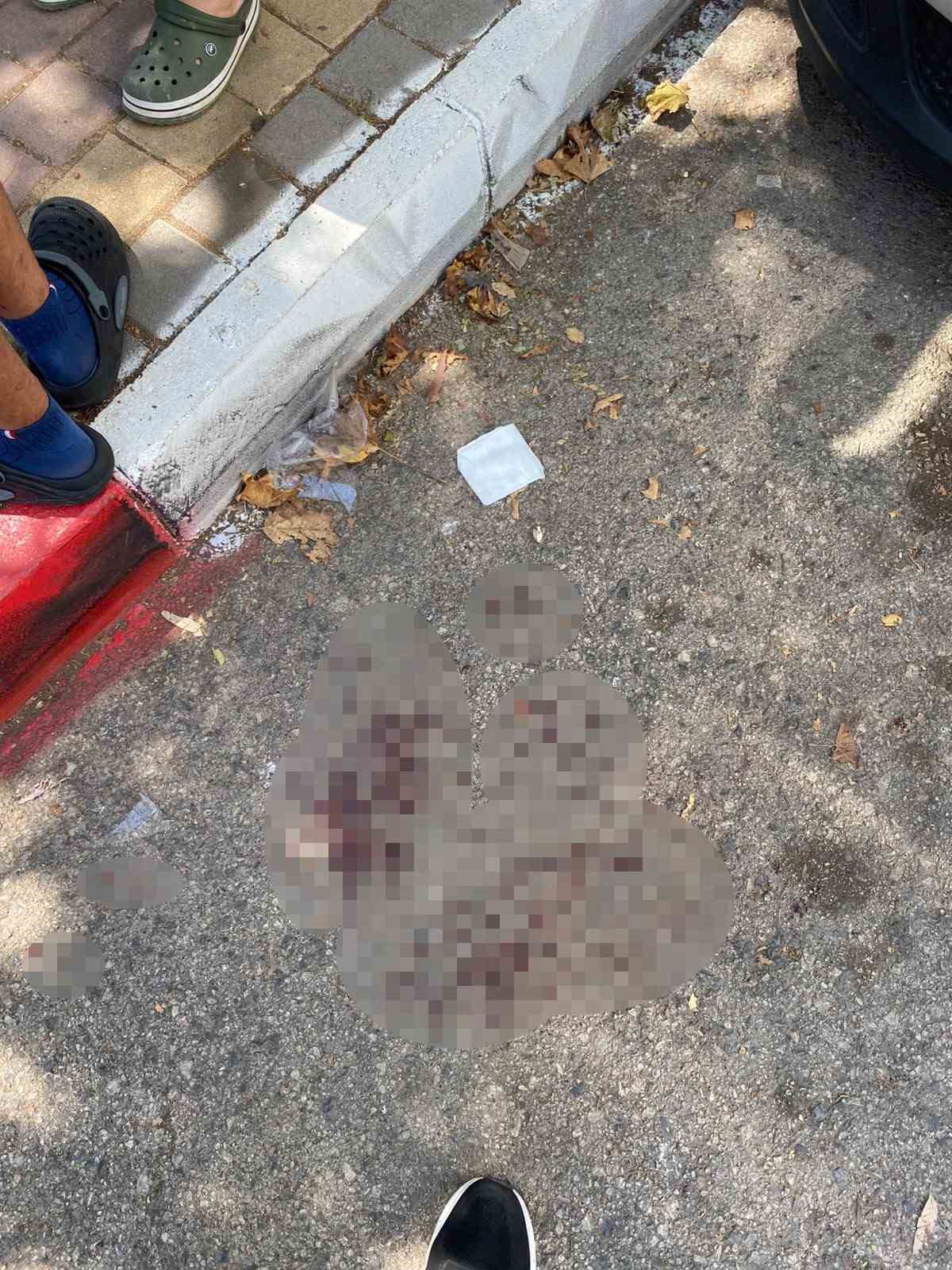 Sipariş almaya gittiği işletmede döner bıçaklı saldırıya uğradı, eline 30 dikiş atıldı