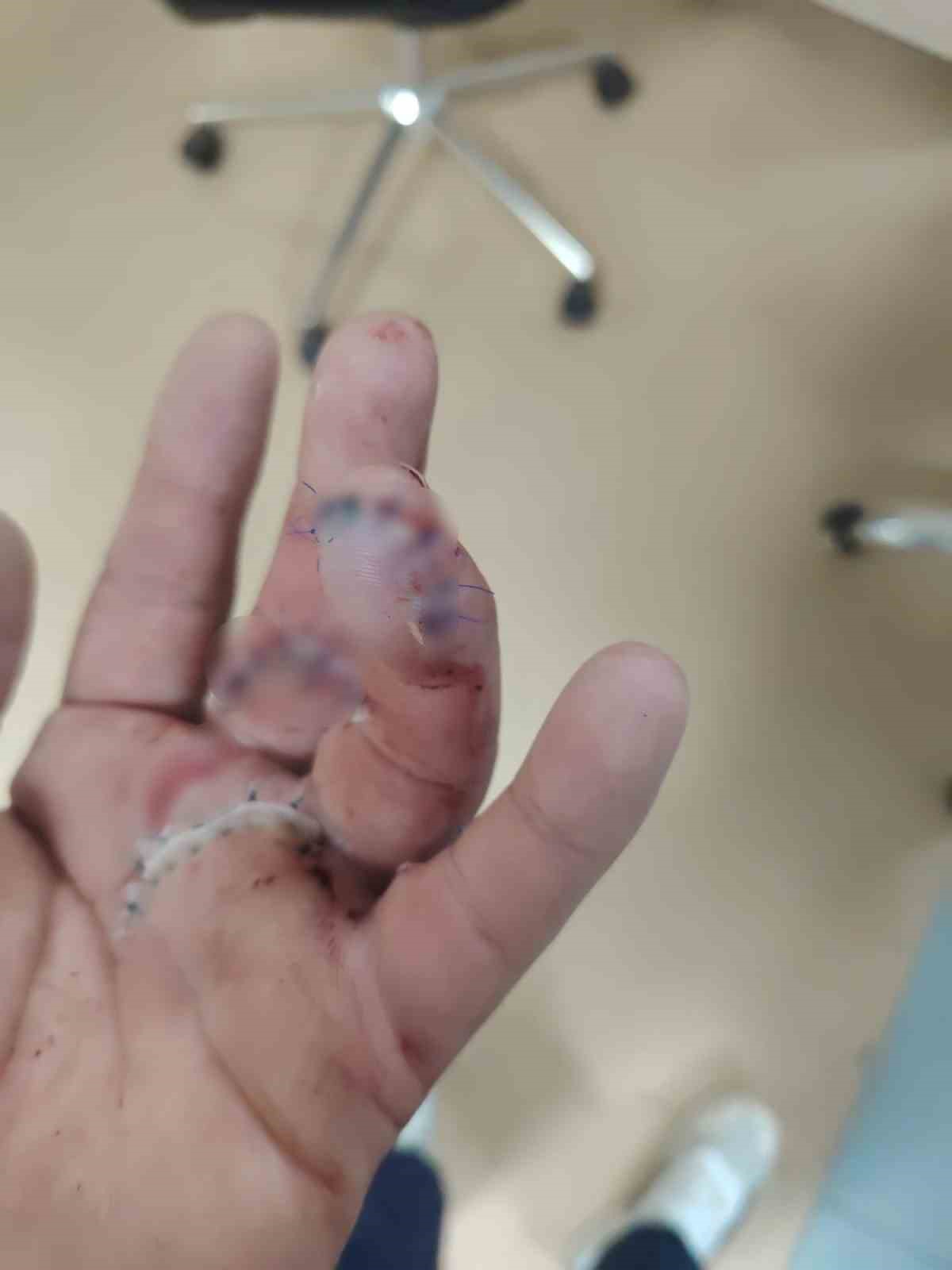 Sipariş almaya gittiği işletmede döner bıçaklı saldırıya uğradı, eline 30 dikiş atıldı