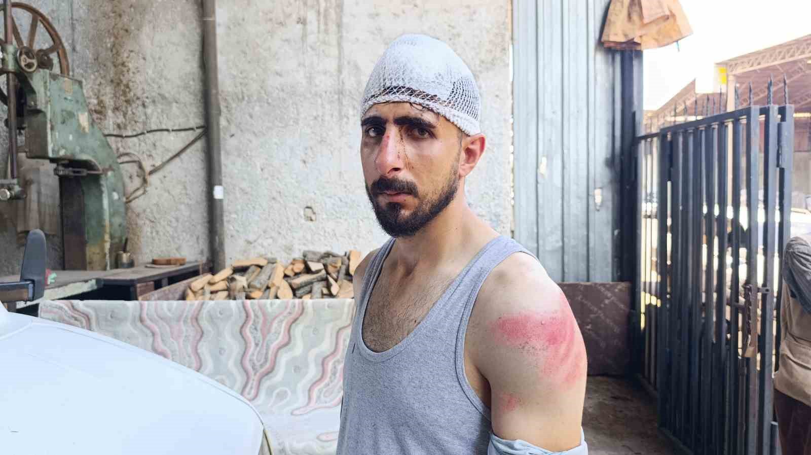 Şanlıurfa’da trafikte yavaş giden sürücüye meydan dayağı: Burnu kırıldı, başına 8 dikiş atıldı