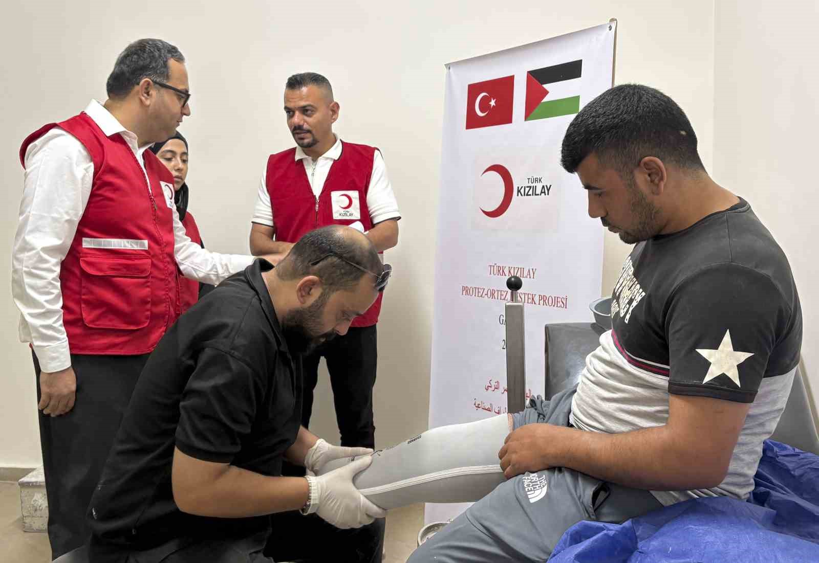 Türk Kızılay Gazze’de Protez Destek Projesi başlattı