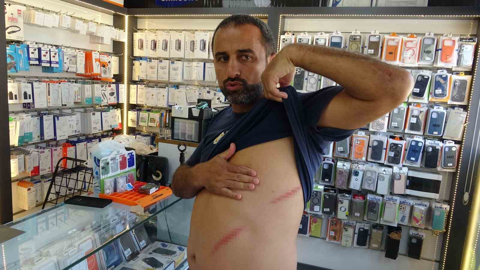 Çivili sopalarla kira kavgası