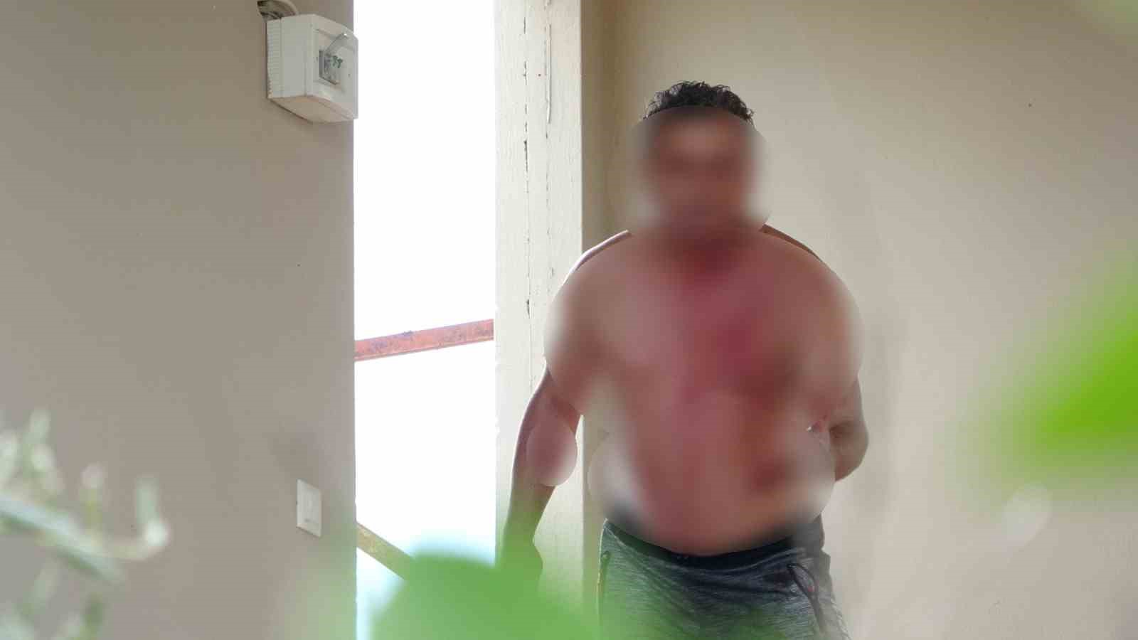 Çalıştığı otelin lojmanın çatısında ‘karım gelecek’ diye usturalı eylem yaptı