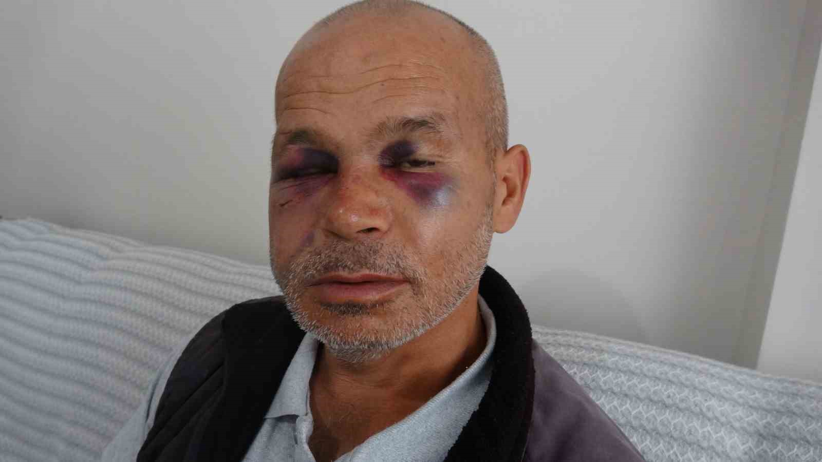 Duyma ve konuşma engelli adamı darp ettiler, aile şikayetçi oldu