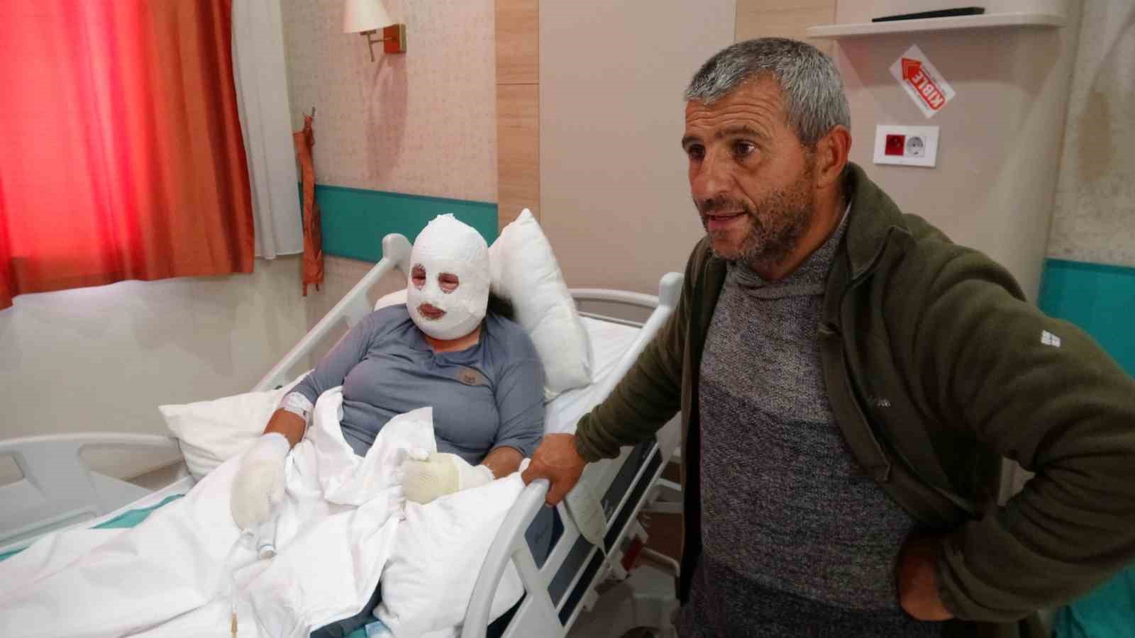 Kızını kurtarmak için alevlerin arasına girdi, kendisi de yandı