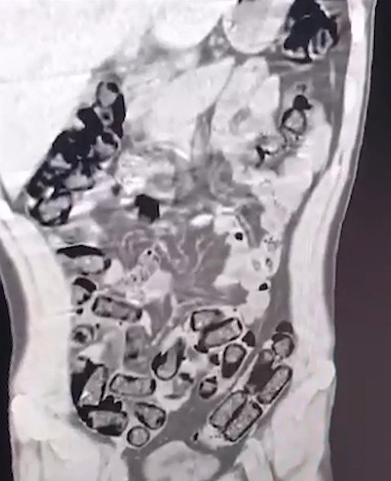 Muş’ta 1 kilo 146 gram metamfetamin ele geçirildi