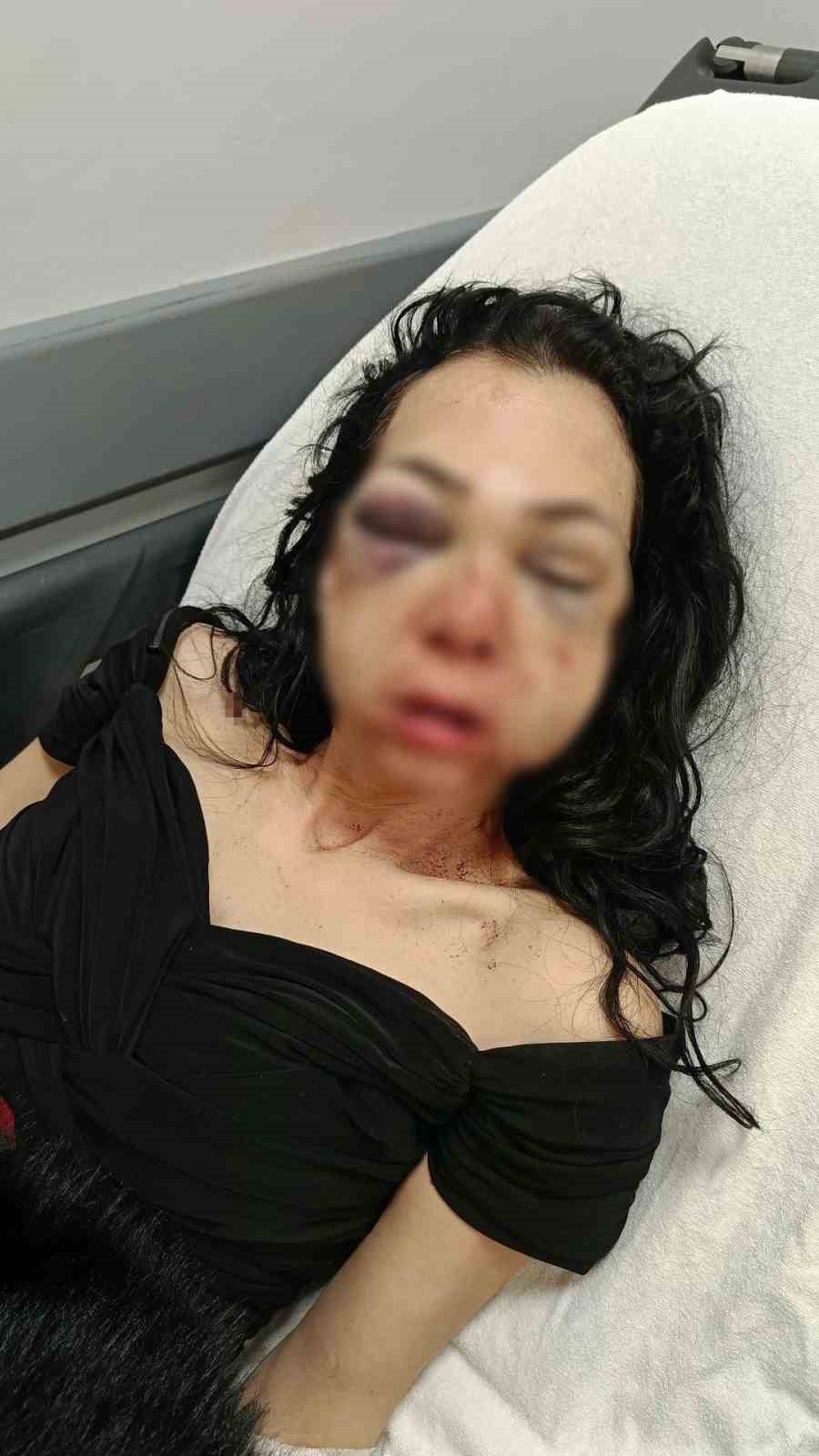 Bayram günü kadının yüzünü bardak ve kül tablasıyla kırmıştı: Tutuklandı