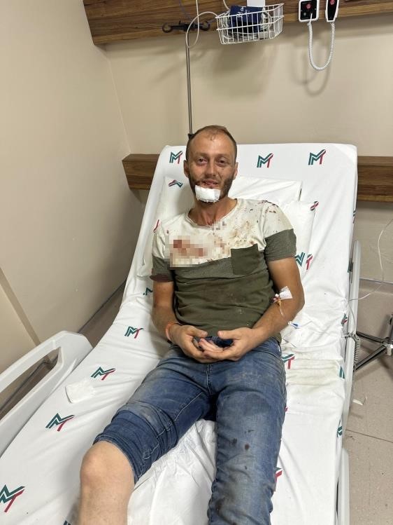 Gürültü tartışması sopalı kavgayla bitti: O anlar kamerada