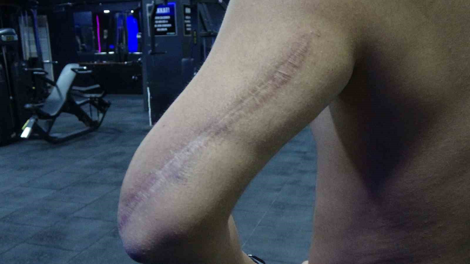 Hayata sporla tutundu: 8 ay tavanı izledi ama spor aşkından vazgeçmedi