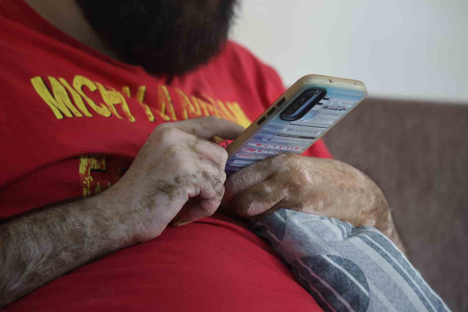 Tedaviyi reddeden telefon bağımlısı Barış, sanal dünyadaki yaşamına geri döndü