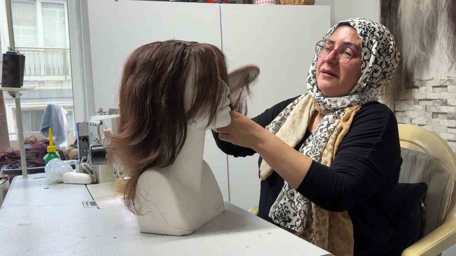 12 yaşında saçlarını ve kulaklarını kaybetti, şimdi kadınlara umut oluyor