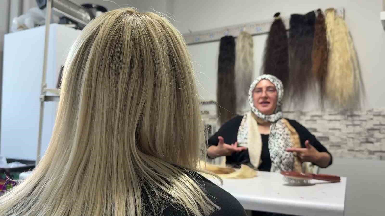 12 yaşında saçlarını ve kulaklarını kaybetti, şimdi kadınlara umut oluyor