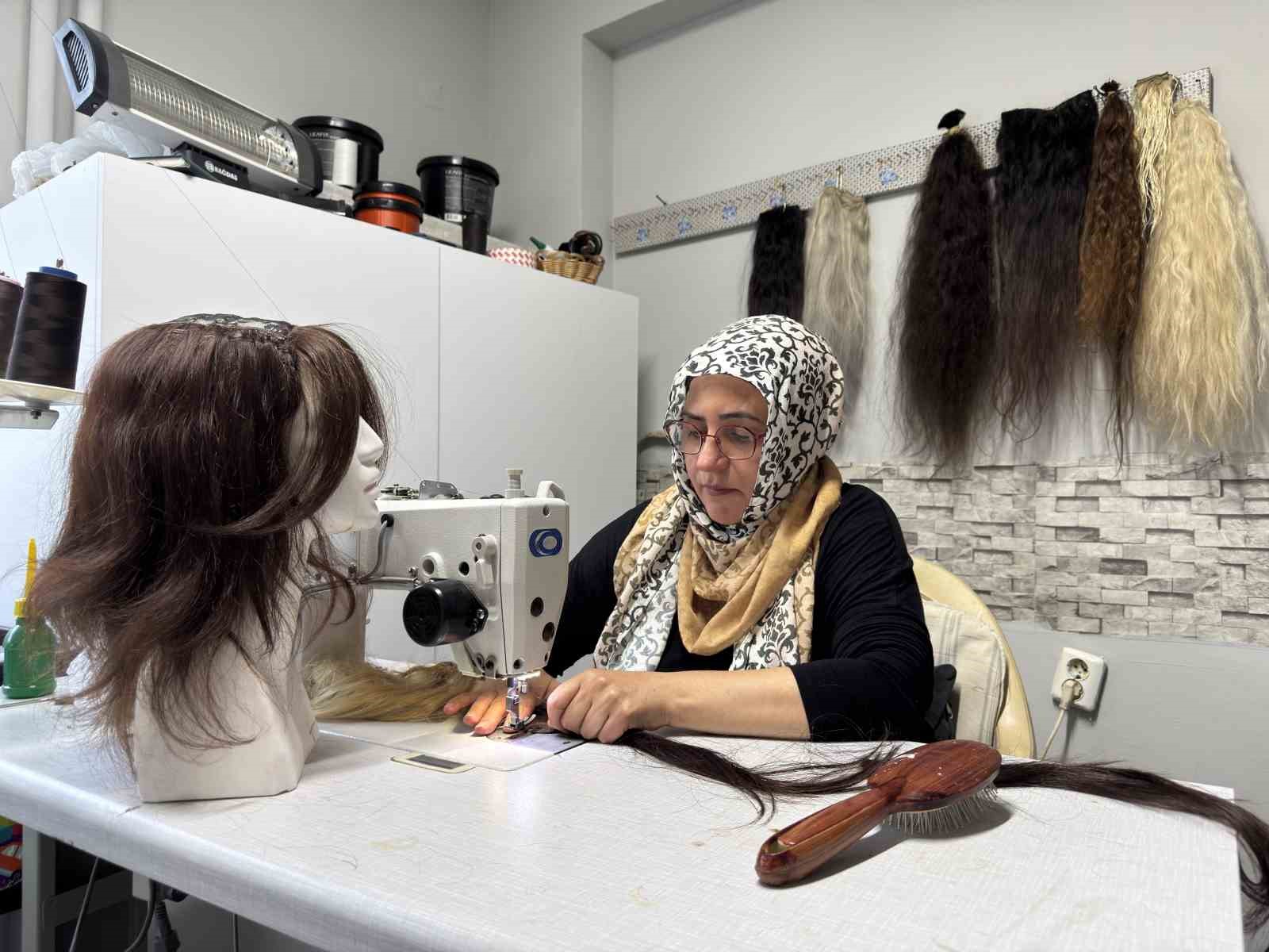 12 yaşında saçlarını ve kulaklarını kaybetti, şimdi kadınlara umut oluyor