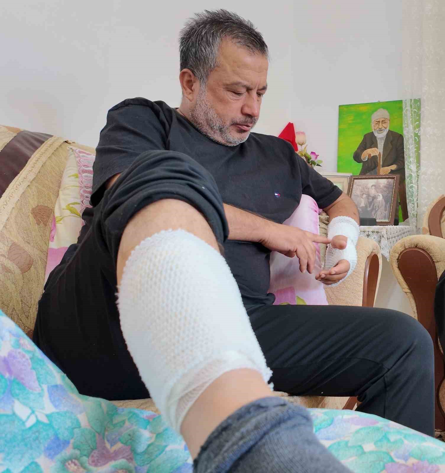 Sahipli köpeğin saldırdığı adam feci şekilde yaralandı