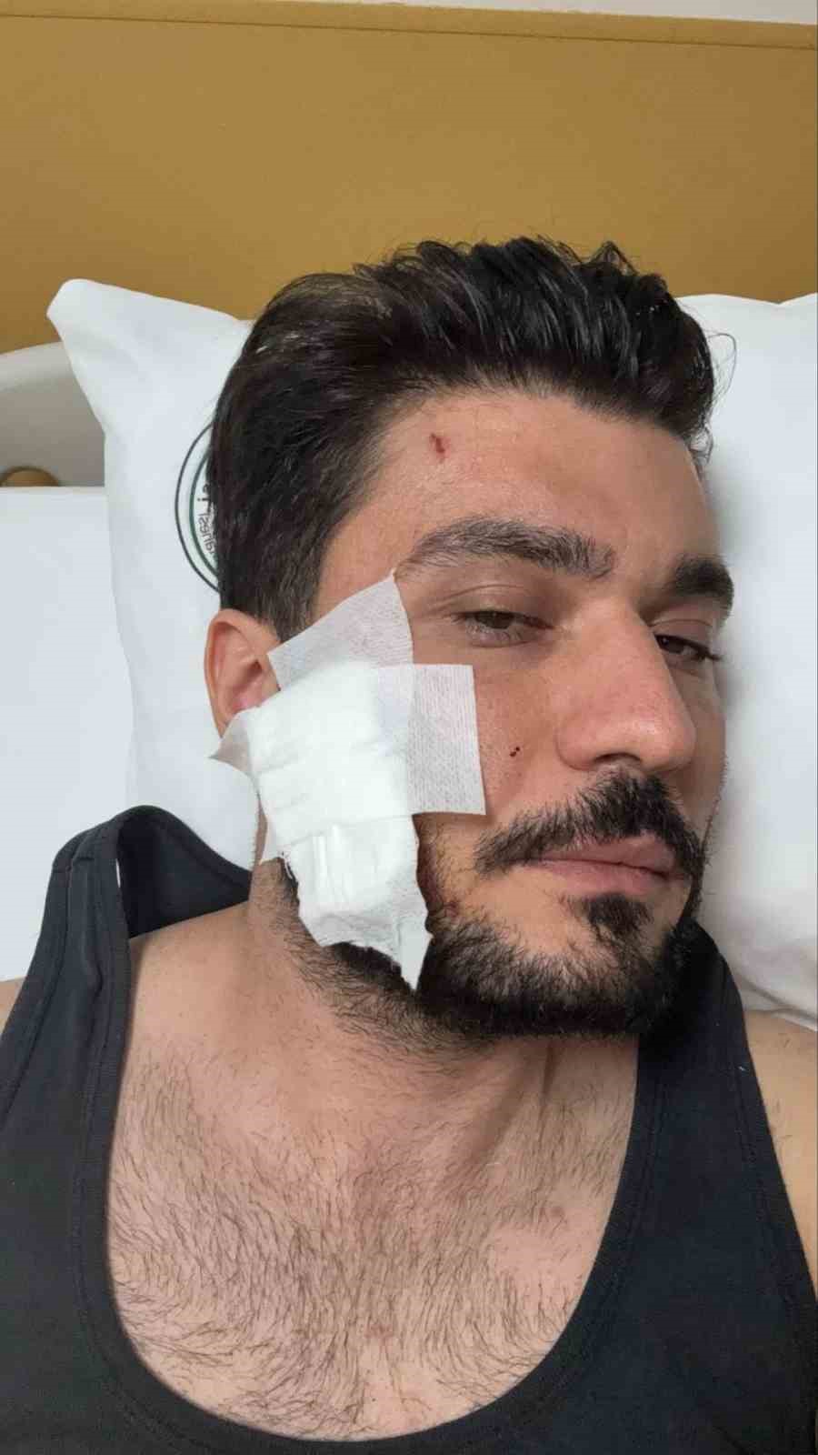 Muşta ile darbettiği iddia edilen taraftan açıklama geldi: "Müvekkilim kesinlikle muşta kullanmamıştır"