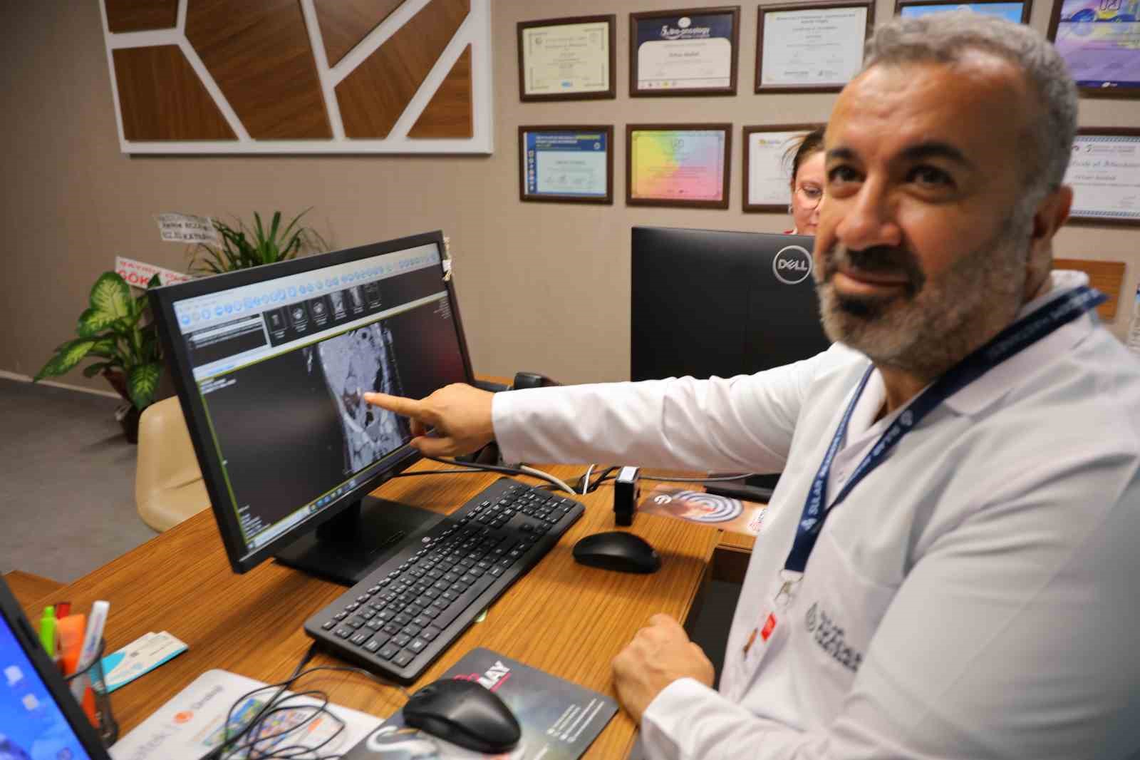Kahramanmaraş’ta 1 yaşındaki bebeğin böbreğinden 2 santimlik taş çıkarıldı