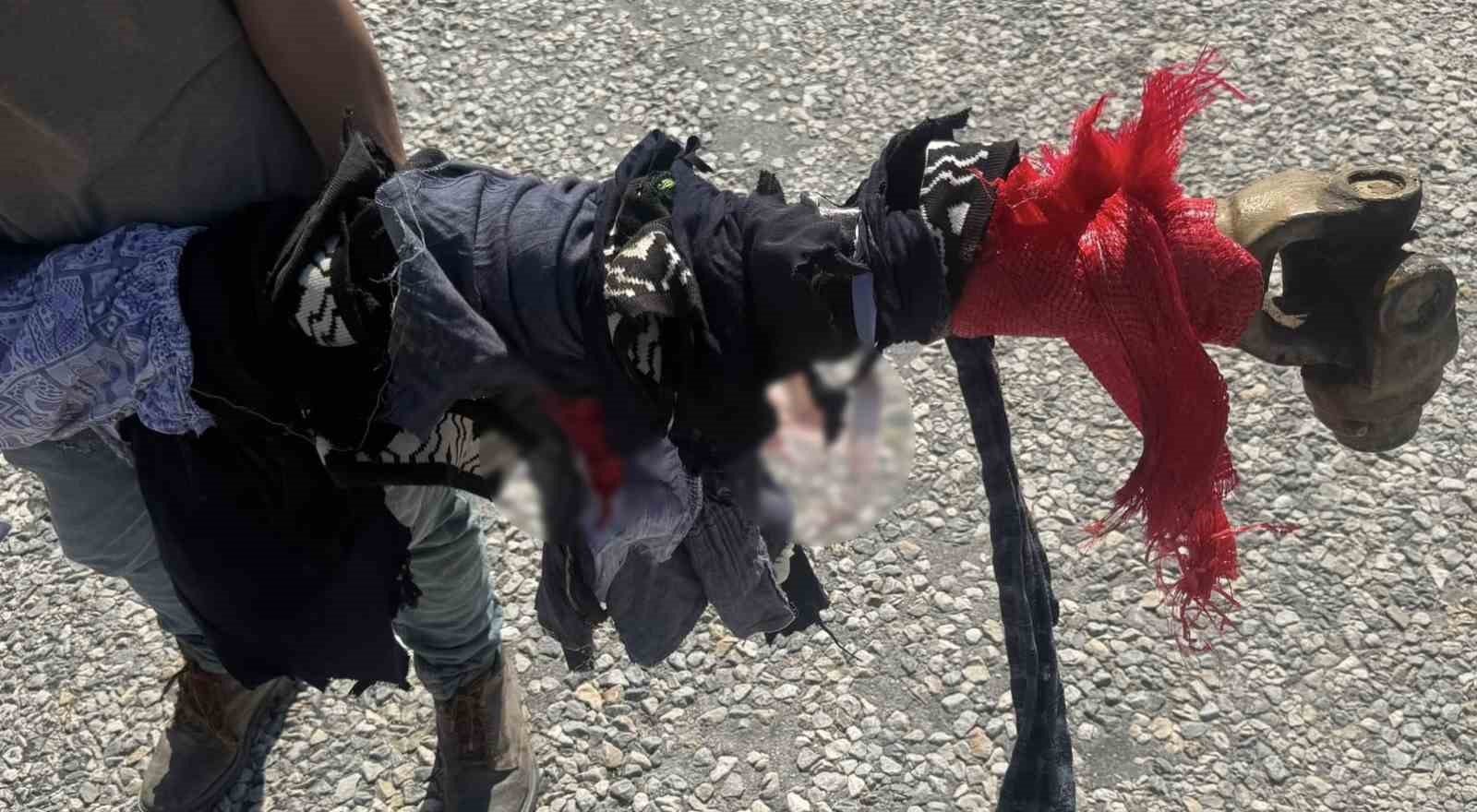 Traktör şaftına kolunu kaptıran kadın ağır yaralandı